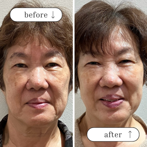 70代